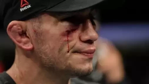 UFC veterán se rozpovídal o tom, kde Tony Ferguson udělal zásadní chybu, že se mu teď nedaří