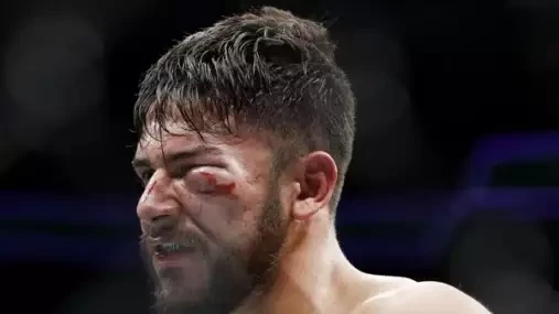 Smolař Rodriguez je opět bez soupeře, Holloway se zranil a UFC shání nový hlavní zápas večera