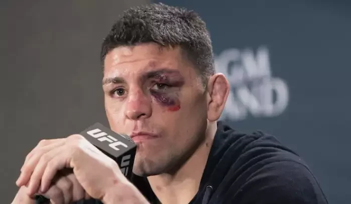 Všechny kritiky si podám jednoho po druhém, ohradil se Nick Diaz proti nevěřící konkurenci 