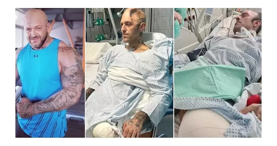 Osud MMA zápasníka Štefana: Ztráta nohou a části lebky po pouliční bitce, případ už řeší policie