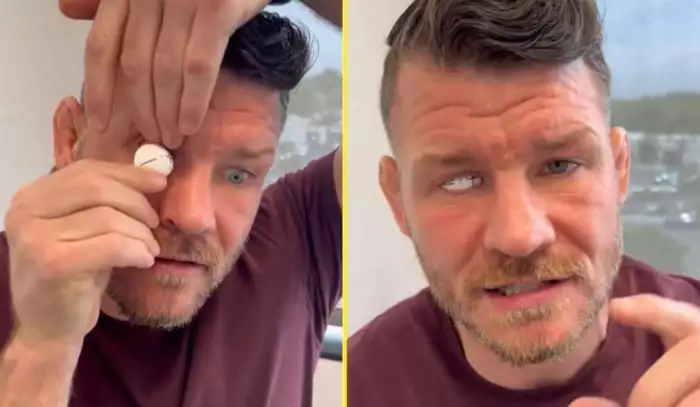 Strach z odhalení, že nevidí na jedno oko. Bisping vzpomíná na nejtěžší momenty mimo klec