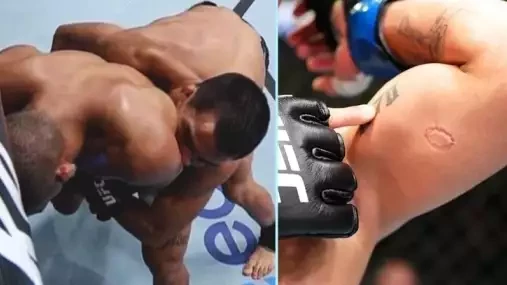 VIDEO: Nevšední ukončení zápasu v UFC! Bojovník se jako vzteklý pitbull zakousl do svého soupeře